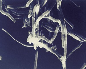 Colonia de la bacteria Escherichia coli.
