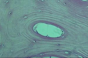 Tejido óseo visto al microscopio.