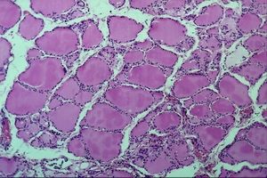 :Sección de la glándula tiroides vista al microscopio.
